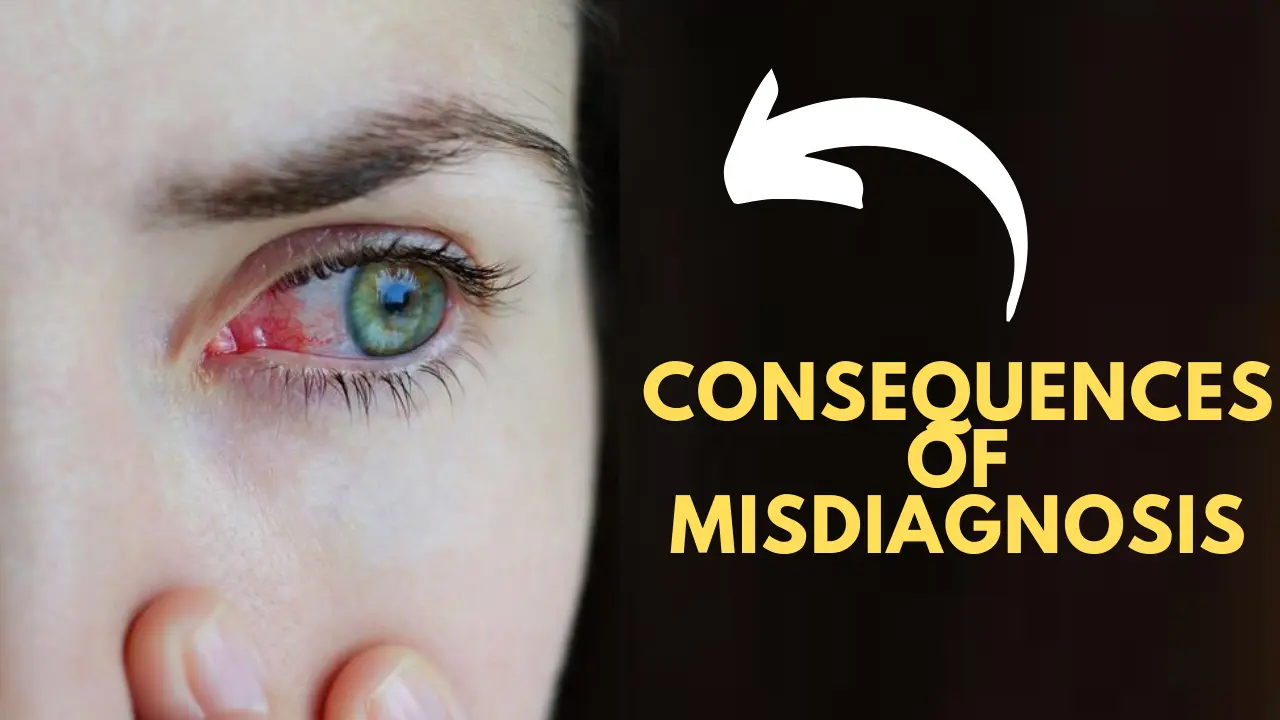 What is commonly misdiagnosed as pink eye