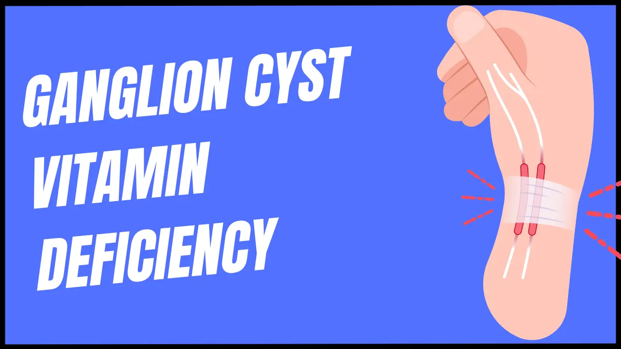 Ganglion cyst vitamin deficiency